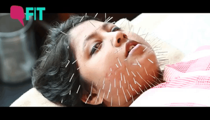 Needles in Face (Alt)