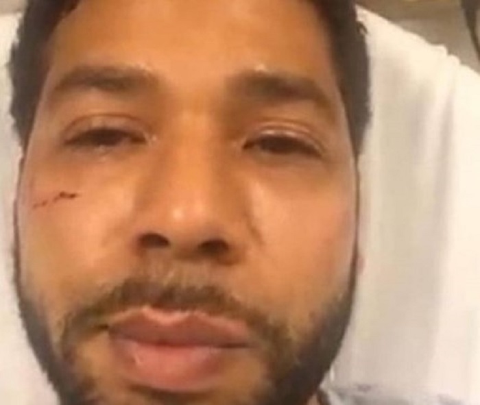 Jussie Smollett in Hospital (Alt)